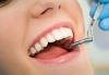 Behandlung von Zahnfleischerkrankungen (Parodontologie)