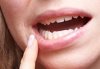 Maxillofacial Prosthodontic Reconstruction