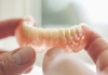 Prosthodontics